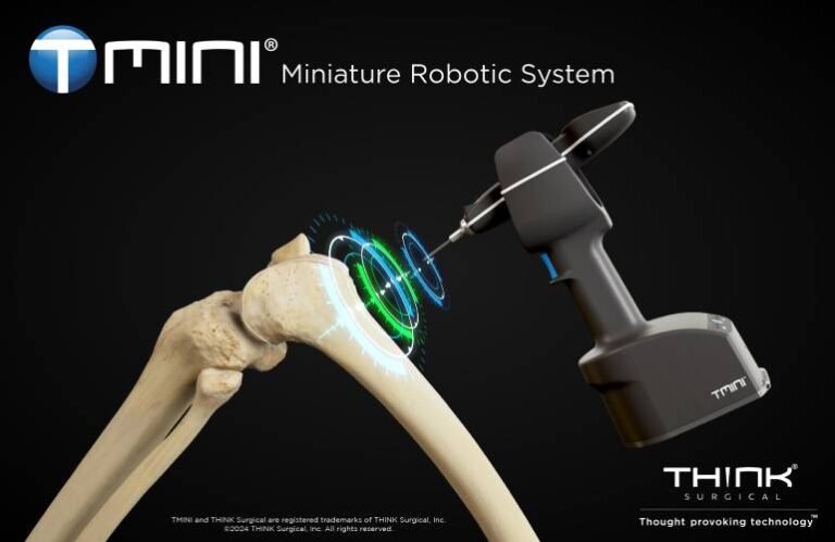 An illustration of just the bones of a bent knee with the handheld TMINI robotic system scanning the bones. 