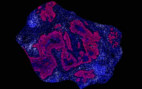 A blueprint for better cancer immunotherapies