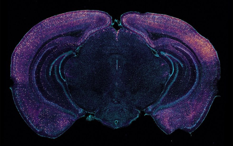 A colored microscope image of an animal brain with many dots lit within.