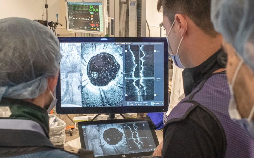 Three medical staffers stand in front of monitors showing imaging that is very clear and crisp.