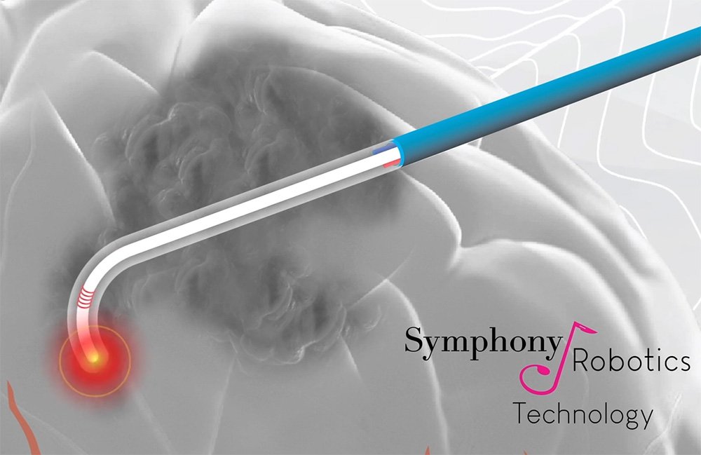 An illustration of a surgical instrument in front of a brain. In the corner is the Symphony Robotics logo. 